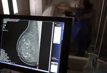 Médicos lançam guia para evitar recusa de mamografia digital